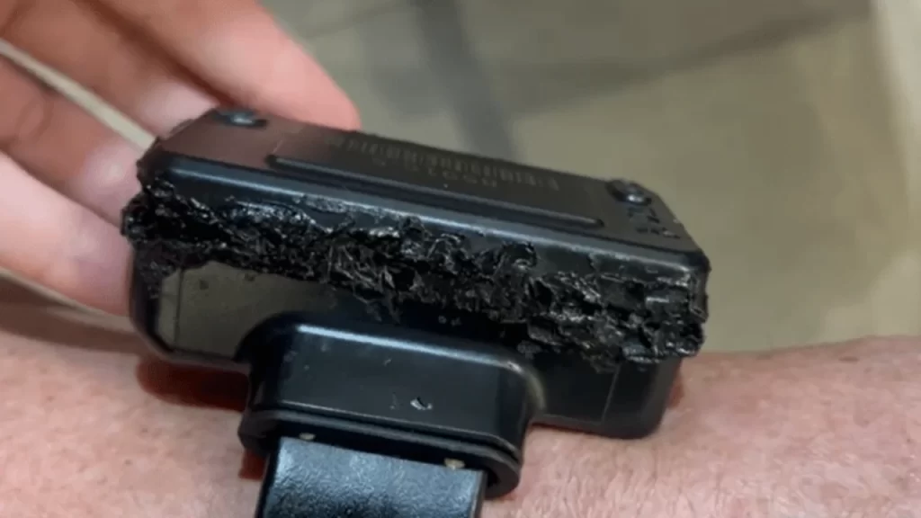 relatorio-aponta-queimaduras-e-avarias-em-tornozeleira;-bolsonaro-admitiu-uso-de-ferro-de-solda