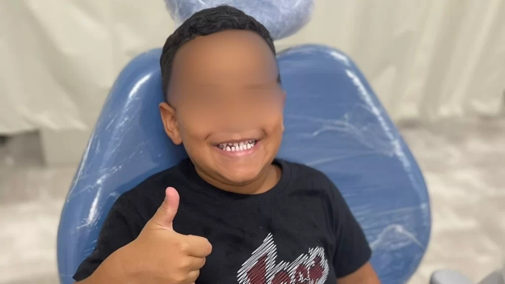 refaces-defende-cuidado-integral-a-criancas-com-deformidades-craniofaciais