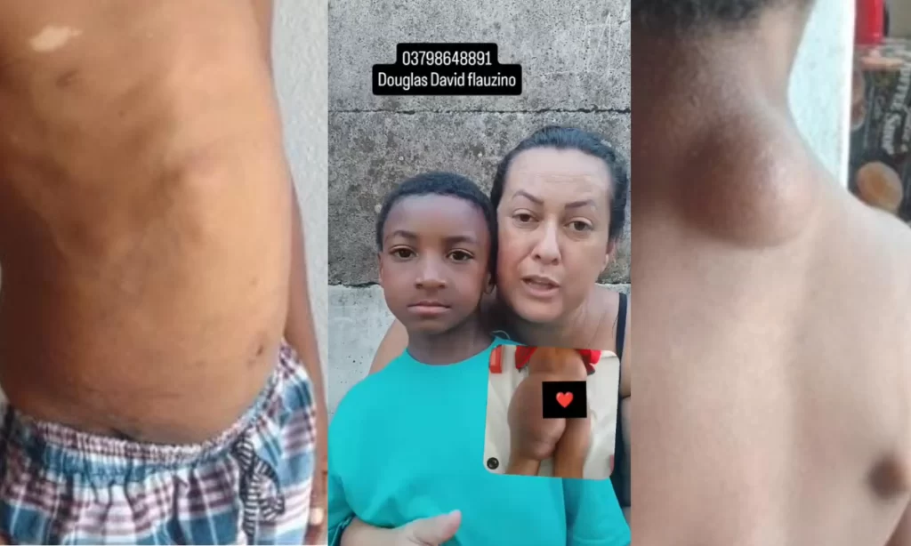 menino-com-doenca-rara-intriga-medicos-e-preocupa-familia-em-itapecerica