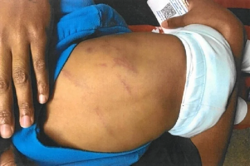 mae-e-padrasto-sao-presos-apos-torturarem-bebe-de-1-ano-com-chutes-e-mordidas-em-dourados